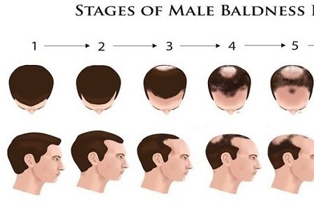 When he needs space how long