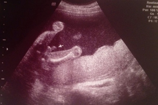 Find friends iphone app gone